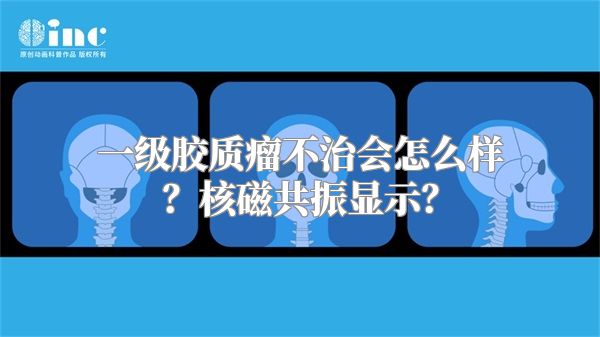 一级胶质瘤不治会怎么样？核磁共振显示？