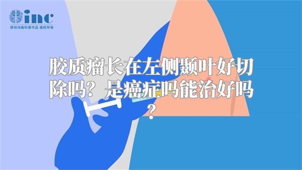 胶质瘤长在左侧颞叶好切除吗？是癌症吗能治好吗？