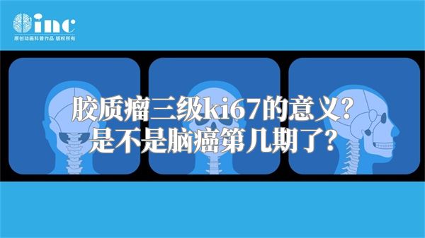 胶质瘤三级ki67的意义？是不是脑癌第几期了？