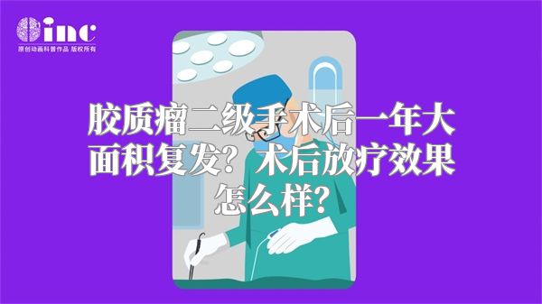 胶质瘤二级手术后一年大面积复发？术后放疗效果怎么样？