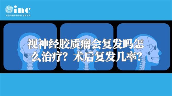 视神经胶质瘤会复发吗怎么治疗？术后复发几率？