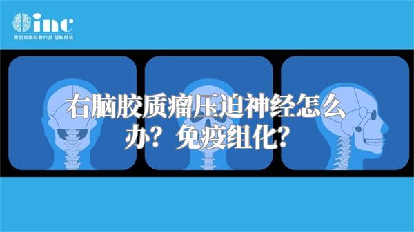 右脑胶质瘤压迫神经怎么办？免疫组化？