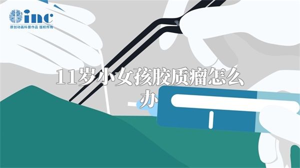 11岁小女孩胶质瘤怎么办