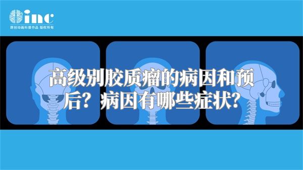 高级别胶质瘤的病因和预后？病因有哪些症状？