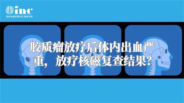 胶质瘤放疗后体内出血严重，放疗核磁复查结果？