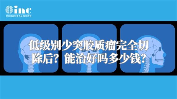 低级别少突胶质瘤完全切除后？能治好吗多少钱？