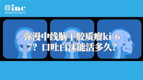 弥漫中线脑干胶质瘤ki-67？口吐白沫能活多久？