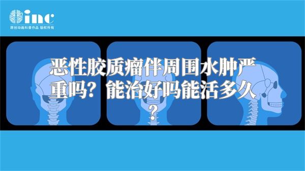 恶性胶质瘤伴周围水肿严重吗？能治好吗能活多久？