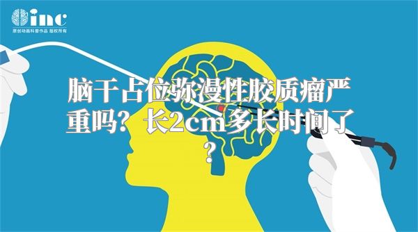 脑干占位弥漫性胶质瘤严重吗？长2cm多长时间了？