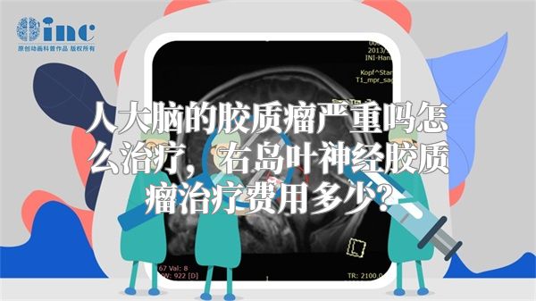 人大脑的胶质瘤严重吗怎么治疗，右岛叶神经胶质瘤治疗费用多少？