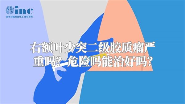 右额叶少突二级胶质瘤严重吗？危险吗能治好吗？