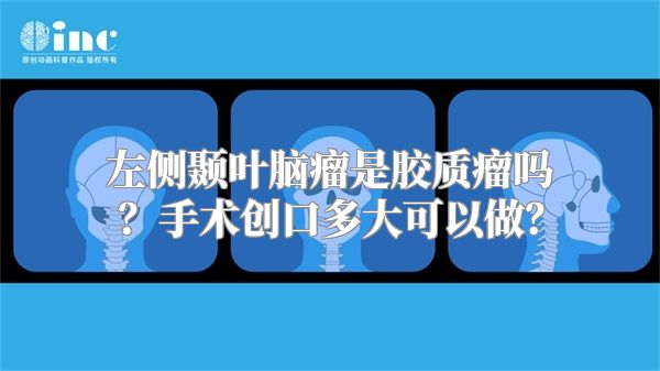 左侧颞叶脑瘤是胶质瘤吗？手术创口多大可以做？