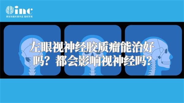 左眼视神经胶质瘤能治好吗？都会影响视神经吗？