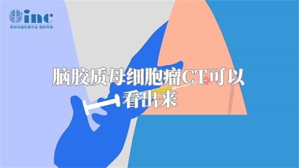 脑胶质母细胞瘤CT可以看出来