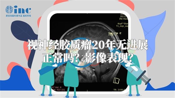 视神经胶质瘤20年无进展正常吗？影像表现？