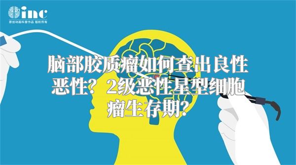 脑部胶质瘤如何查出良性恶性？2级恶性星型细胞瘤生存期？