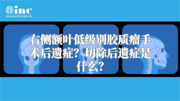 右侧额叶低级别胶质瘤手术后遗症？切除后遗症是什么？