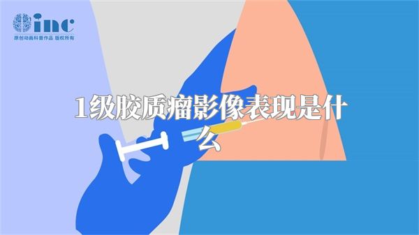 1级胶质瘤影像表现是什么