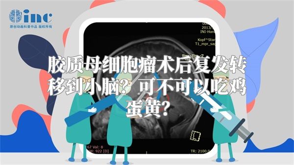 胶质母细胞瘤术后复发转移到小脑？可不可以吃鸡蛋黄？