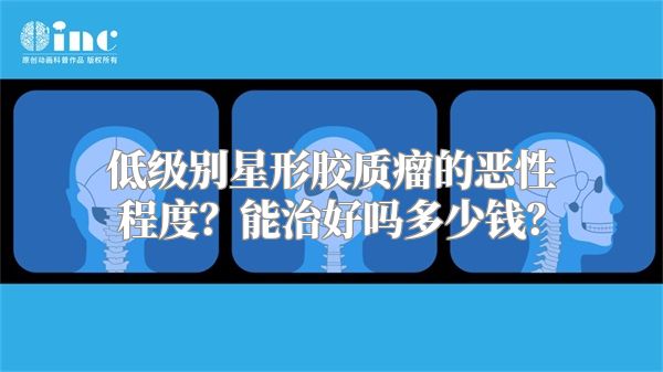 低级别星形胶质瘤的恶性程度？能治好吗多少钱？