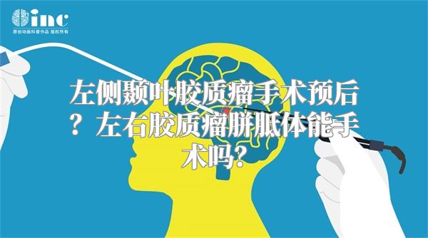 左侧颞叶胶质瘤手术预后？左右胶质瘤胼胝体能手术吗？