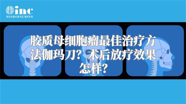 胶质母细胞瘤最佳治疗方法伽玛刀？术后放疗效果怎样？