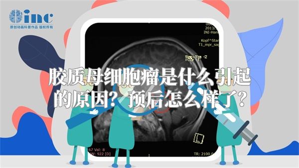 胶质母细胞瘤是什么引起的原因？预后怎么样了？