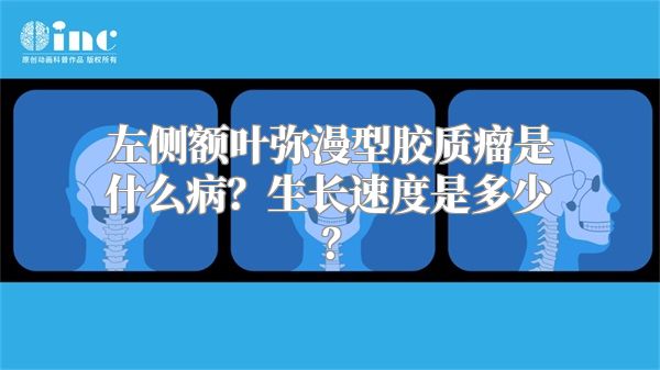 左侧额叶弥漫型胶质瘤是什么病？生长速度是多少？