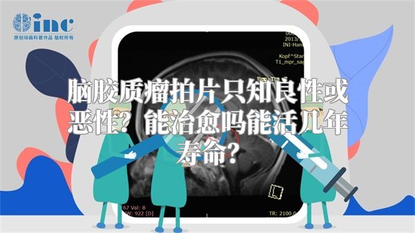 脑胶质瘤拍片只知良性或恶性？能治愈吗能活几年寿命？