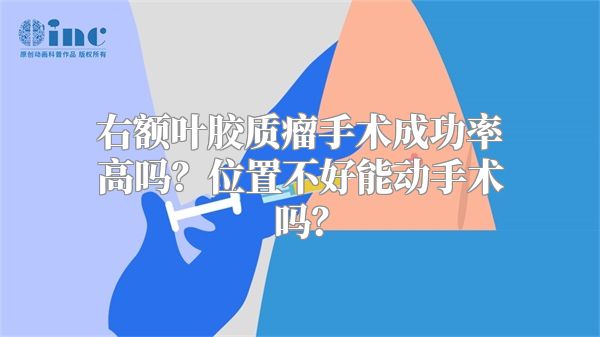 右额叶胶质瘤手术成功率高吗？位置不好能动手术吗？