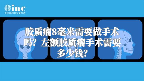 胶质瘤8毫米需要做手术吗？左额胶质瘤手术需要多少钱？