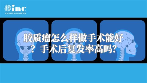 胶质瘤怎么样做手术能好？手术后复发率高吗？