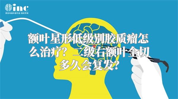 额叶星形低级别胶质瘤怎么治疗？二级右额叶全切多久会复发？