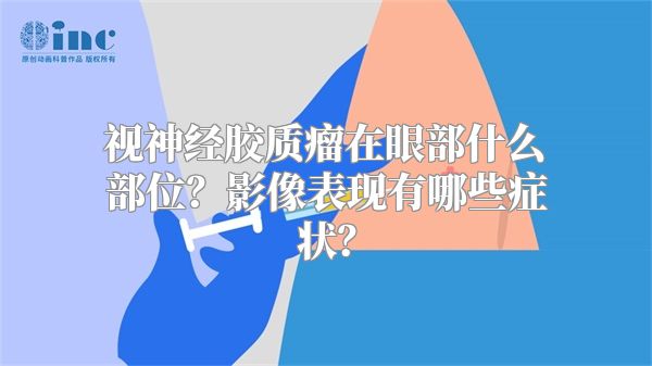 视神经胶质瘤在眼部什么部位？影像表现有哪些症状？