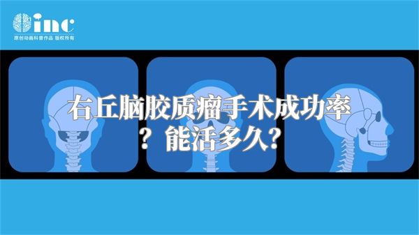 右丘脑胶质瘤手术成功率？能活多久？