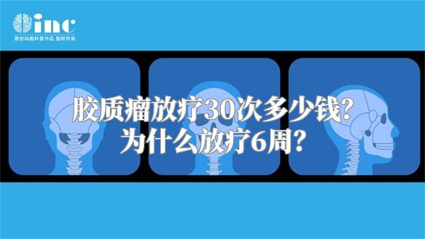 胶质瘤放疗30次多少钱？为什么放疗6周？