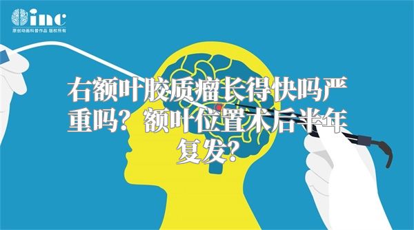 右额叶胶质瘤长得快吗严重吗？额叶位置术后半年复发？