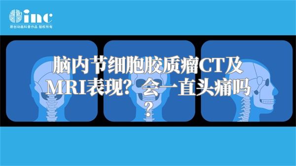 脑内节细胞胶质瘤CT及MRI表现？会一直头痛吗？