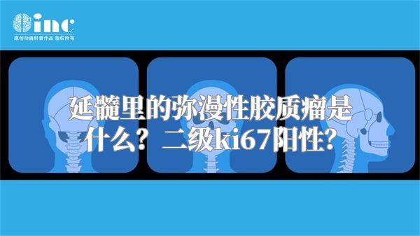 延髓里的弥漫性胶质瘤是什么？二级ki67阳性？