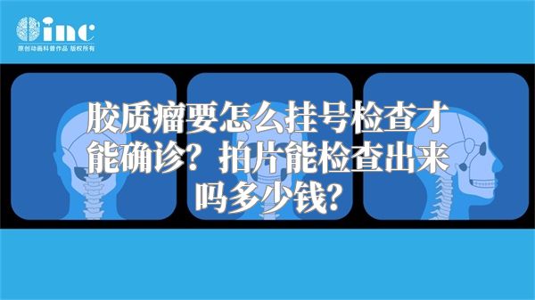 胶质瘤要怎么挂号检查才能确诊？拍片能检查出来吗多少钱？