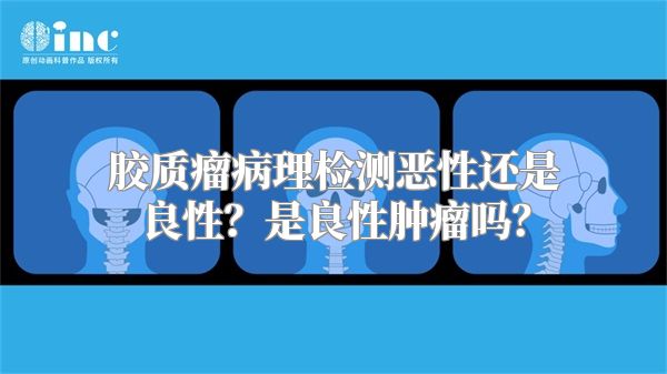 胶质瘤病理检测恶性还是良性？是良性肿瘤吗？