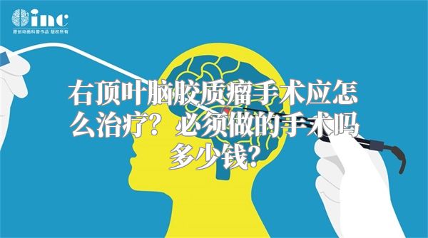 右顶叶脑胶质瘤手术应怎么治疗？必须做的手术吗多少钱？