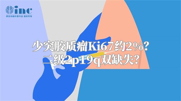 少突胶质瘤Ki67约2%？二级2p19q双缺失？