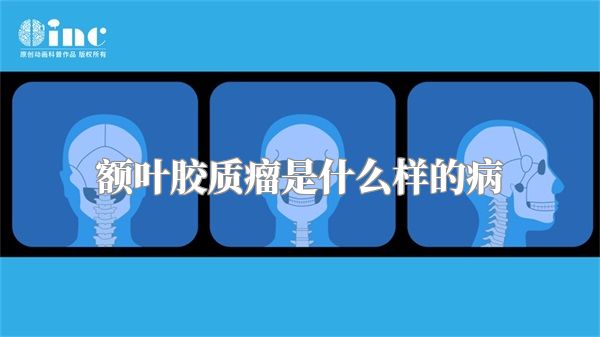 额叶胶质瘤是什么样的病