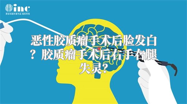 恶性胶质瘤手术后脸发白？胶质瘤手术后右手右腿失灵？