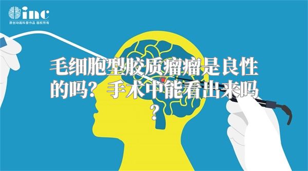 毛细胞型胶质瘤瘤是良性的吗？手术中能看出来吗？