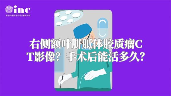 右侧额叶胼胝体胶质瘤CT影像？手术后能活多久？