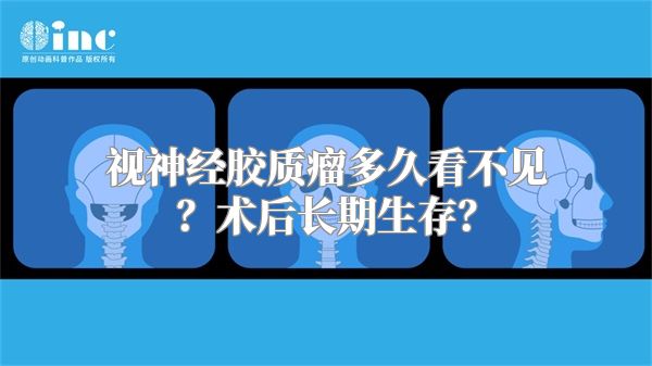 视神经胶质瘤多久看不见？术后长期生存？