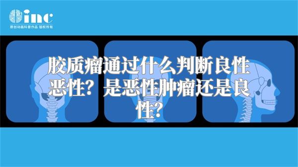 胶质瘤通过什么判断良性恶性？是恶性肿瘤还是良性？