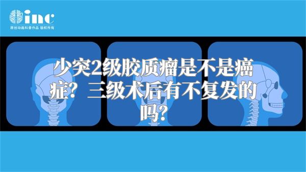 少突2级胶质瘤是不是癌症？三级术后有不复发的吗？